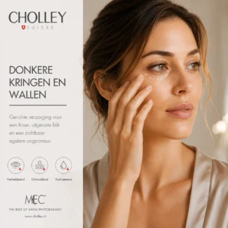 Donkere kringen en wallen