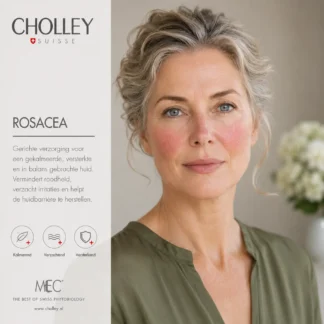 Rosacea-gevoelig