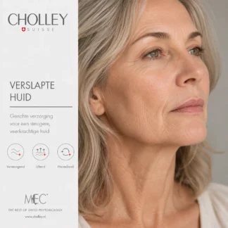 Verslapte huid